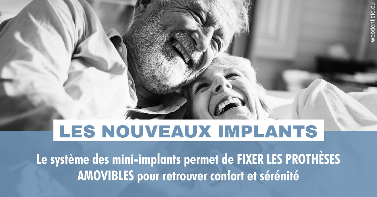 https://www.dentiste-saffar.fr/Les nouveaux implants 2