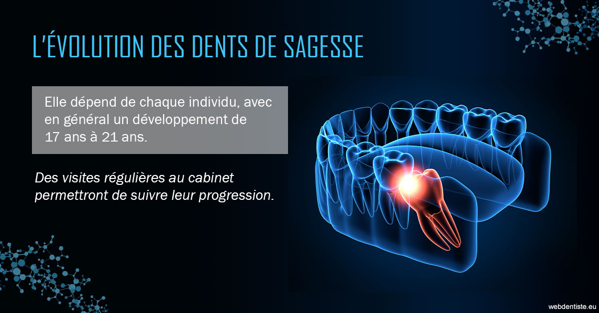 https://www.dentiste-saffar.fr/2023 T4 - Dents de sagesse 01