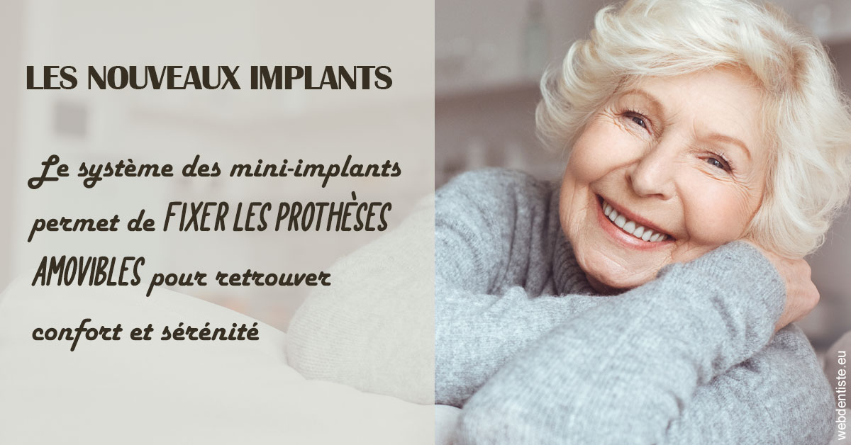 https://www.dentiste-saffar.fr/Les nouveaux implants 1