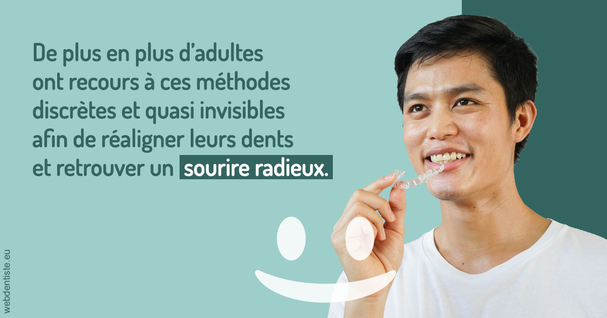 https://www.dentiste-saffar.fr/Gouttières sourire radieux 2