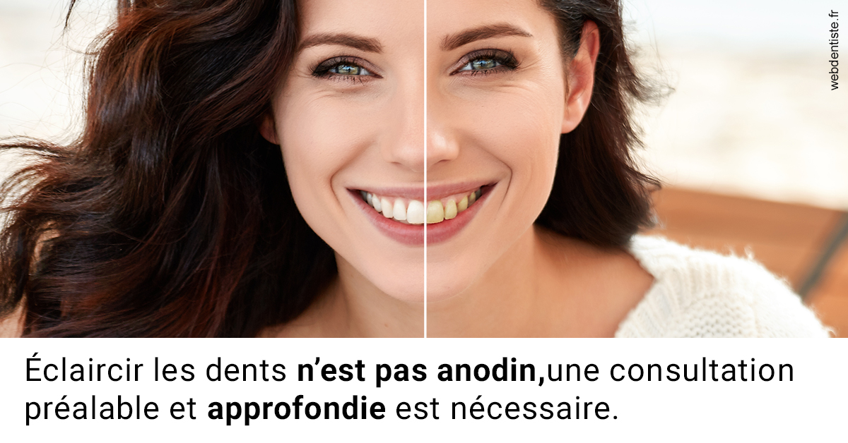 https://www.dentiste-saffar.fr/Le blanchiment 2