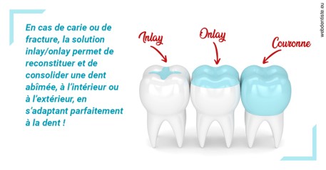 https://www.dentiste-saffar.fr/L'INLAY ou l'ONLAY