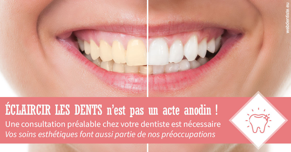 https://www.dentiste-saffar.fr/Eclaircir les dents 1