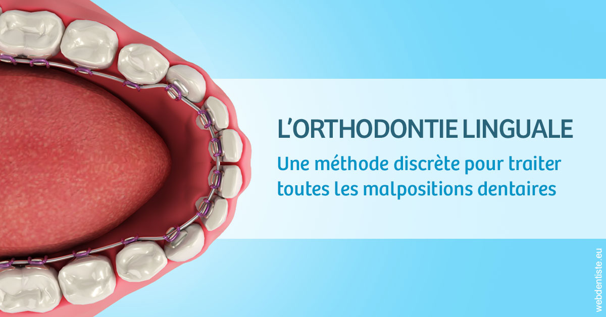 https://www.dentiste-saffar.fr/L'orthodontie linguale 1