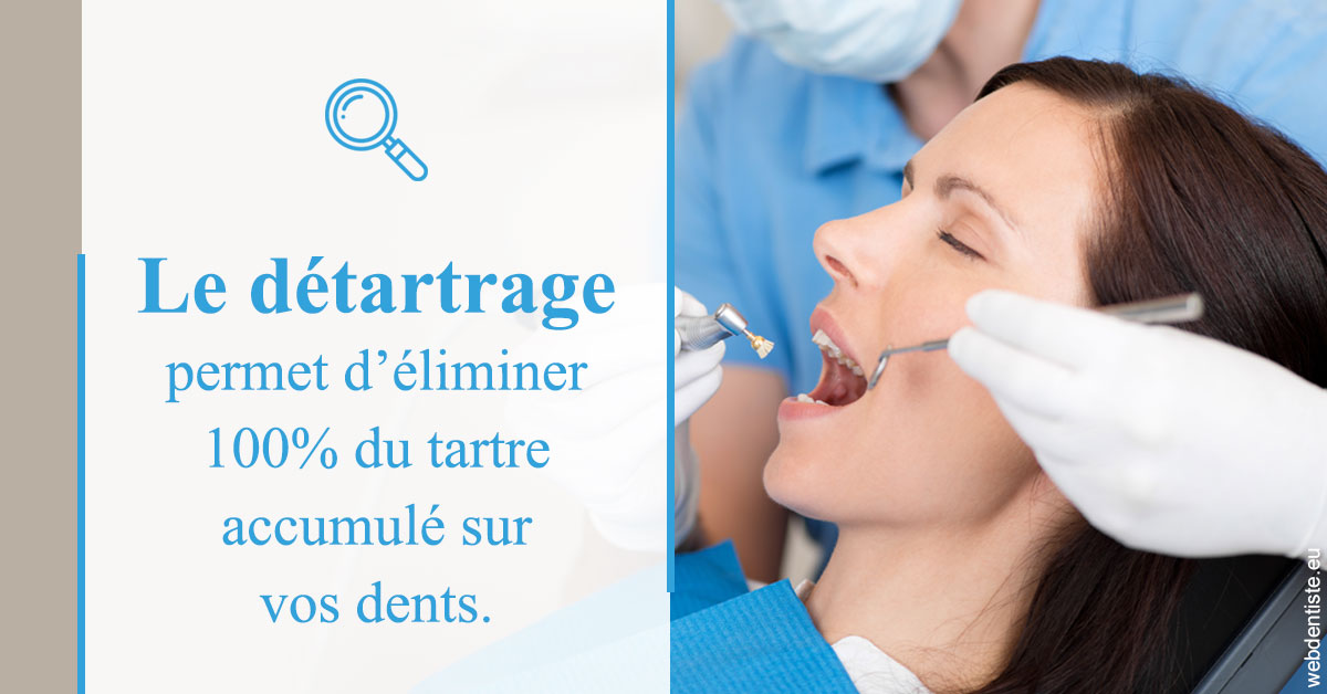 https://www.dentiste-saffar.fr/En quoi consiste le détartrage