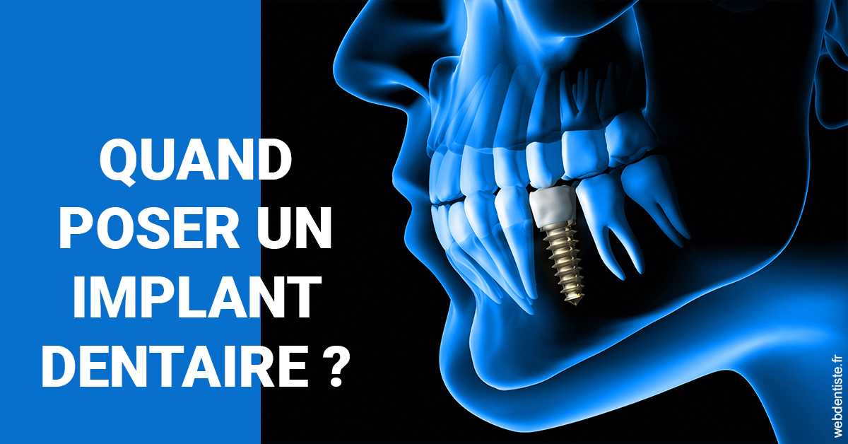 https://www.dentiste-saffar.fr/Les implants 1