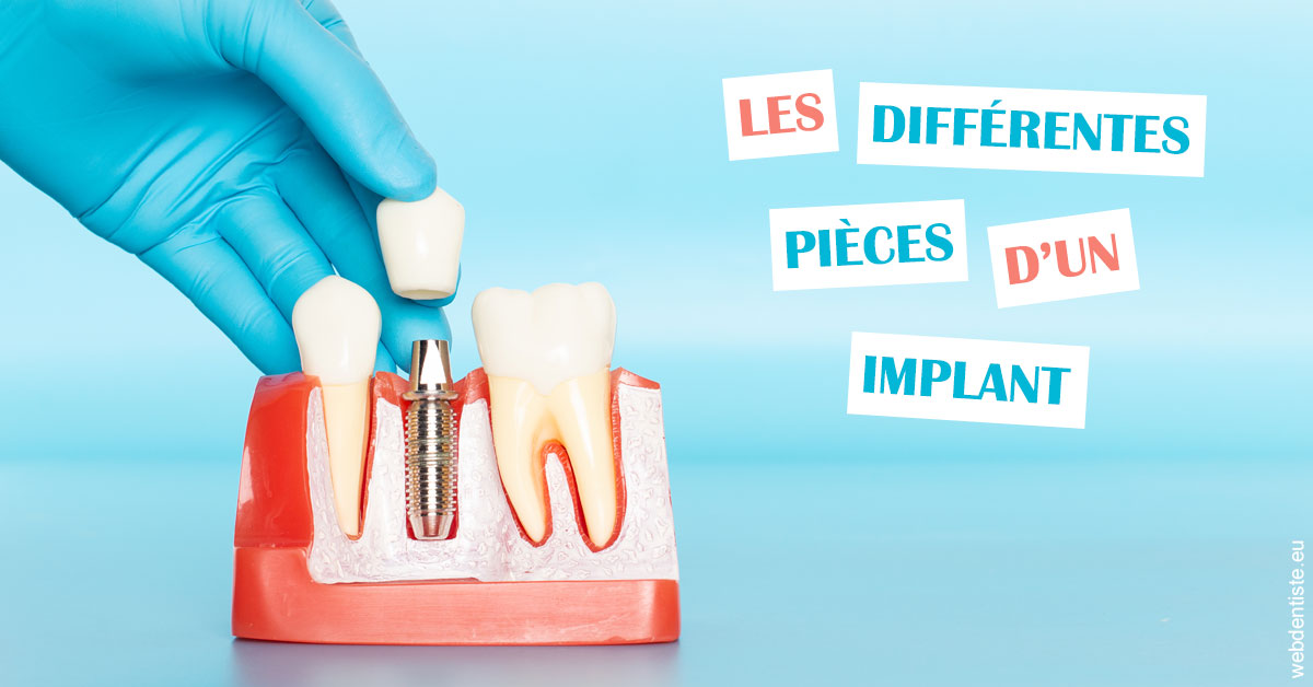 https://www.dentiste-saffar.fr/Les différentes pièces d’un implant 2