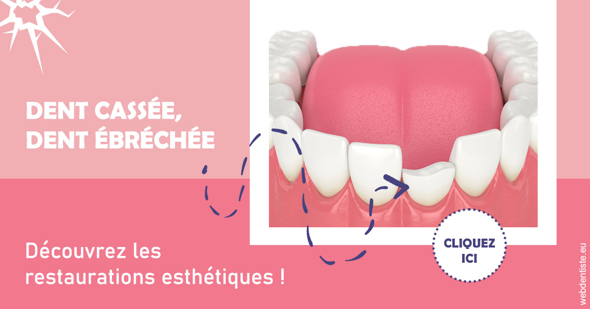 https://www.dentiste-saffar.fr/Dent cassée ébréchée 1