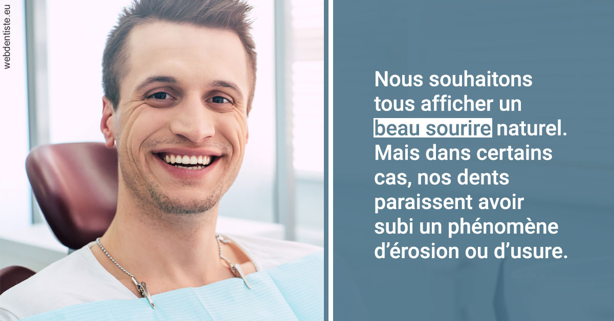 https://www.dentiste-saffar.fr/Érosion et usure dentaire