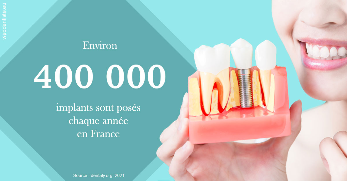 https://www.dentiste-saffar.fr/Pose d'implants en France 2